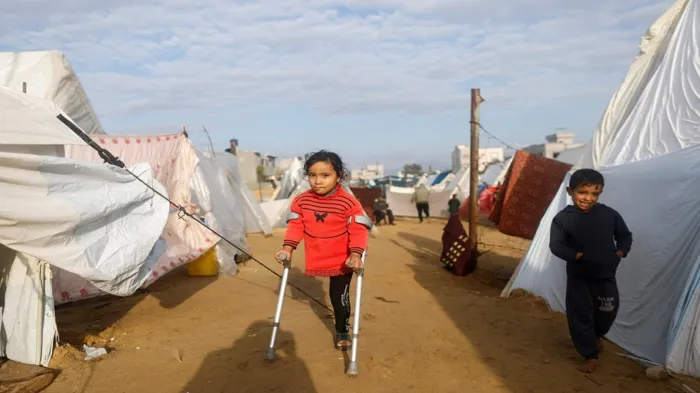 Support and treatment for children who lost limbs